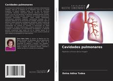 Buchcover von Cavidades pulmonares