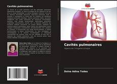 Cavités pulmonaires kitap kapağı