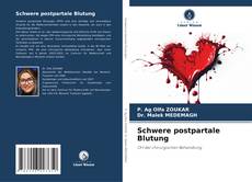 Bookcover of Schwere postpartale Blutung