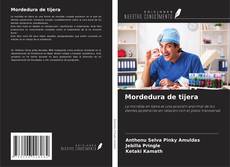 Buchcover von Mordedura de tijera