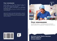 Bookcover of Укус ножницами