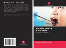 Bookcover of Mordida aberta Maloclusão