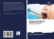 Bookcover of Открытый прикус Малокклюзия