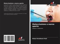 Bookcover of Malocclusione a morso aperto