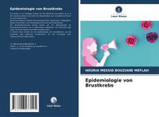 Epidemiologie von Brustkrebs kitap kapağı