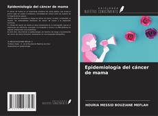 Buchcover von Epidemiología del cáncer de mama