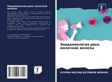 Bookcover of Эпидемиология рака молочной железы
