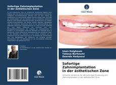 Couverture de Sofortige Zahnimplantation in der ästhetischen Zone