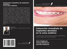 Portada del libro de Colocación inmediata de implantes dentales en la zona estética
