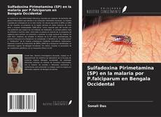 Buchcover von Sulfadoxina Pirimetamina (SP) en la malaria por P.falciparum en Bengala Occidental