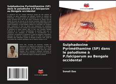 Capa do livro de Sulphadoxine Pyriméthamine (SP) dans le paludisme à P.falciparum au Bengale occidental 
