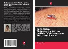 Sulfadoxina Pirimetamina (SP) na malária P.falciparum em Bengala Ocidental的封面