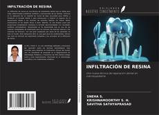 Bookcover of INFILTRACIÓN DE RESINA
