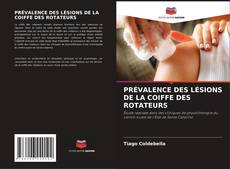 Buchcover von PRÉVALENCE DES LÉSIONS DE LA COIFFE DES ROTATEURS