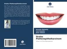 Buchcover von Orales Plattenepithelkarzinom