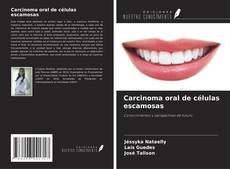 Capa do livro de Carcinoma oral de células escamosas 