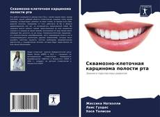 Bookcover of Сквамозно-клеточная карцинома полости рта