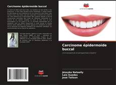 Capa do livro de Carcinome épidermoïde buccal 