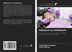 Buchcover von Adhesivo en ortodoncia