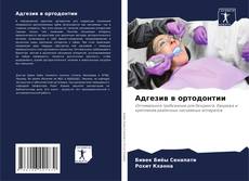 Bookcover of Адгезив в ортодонтии
