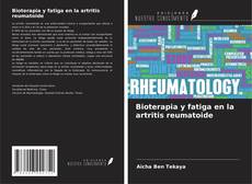 Buchcover von Bioterapia y fatiga en la artritis reumatoide