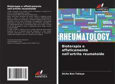 Bookcover of Bioterapia e affaticamento nell'artrite reumatoide