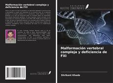 Capa do livro de Malformación vertebral compleja y deficiencia de FXI 