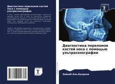 Capa do livro de Диагностика переломов костей носа с помощью ультрасонографии 