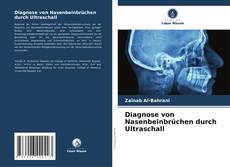 Diagnose von Nasenbeinbrüchen durch Ultraschall kitap kapağı