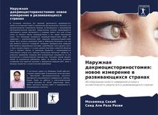 Bookcover of Наружная дакриоцисториностомия: новое измерение в развивающихся странах