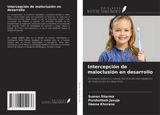 Bookcover of Intercepción de maloclusión en desarrollo