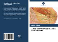 Buchcover von Alles über fibroepitheliale Brusttumore