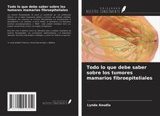Обложка Todo lo que debe saber sobre los tumores mamarios fibroepiteliales