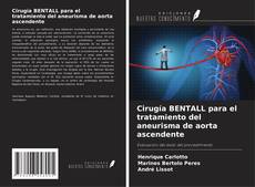 Buchcover von Cirugía BENTALL para el tratamiento del aneurisma de aorta ascendente
