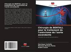 Copertina di Chirurgie de BENTALL pour le traitement de l'anévrisme de l'aorte ascendante