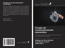 Bookcover of Cirugía de revascularización miocárdica