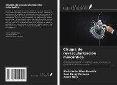 Copertina di Cirugía de revascularización miocárdica