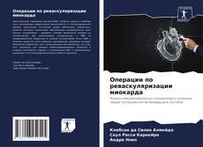 Bookcover of Операции по реваскуляризации миокарда