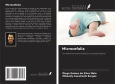 Buchcover von Microcefalia