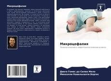 Bookcover of Микроцефалия