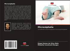 Bookcover of Microcéphalie