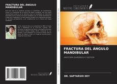 Buchcover von FRACTURA DEL ÁNGULO MANDIBULAR