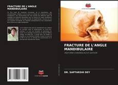 Buchcover von FRACTURE DE L'ANGLE MANDIBULAIRE