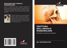 Copertina di FRATTURA DELL'ANGOLO MANDIBOLARE