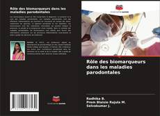 Copertina di Rôle des biomarqueurs dans les maladies parodontales