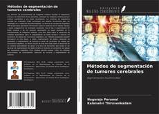 Capa do livro de Métodos de segmentación de tumores cerebrales 