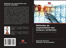 Copertina di Méthodes de segmentation des tumeurs cérébrales