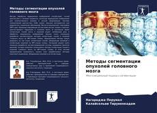 Bookcover of Методы сегментации опухолей головного мозга