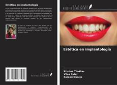 Capa do livro de Estética en implantología 