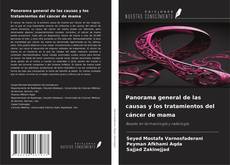 Обложка Panorama general de las causas y los tratamientos del cáncer de mama